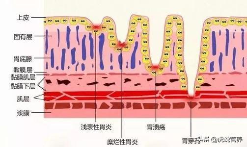 胃不好需要吃什么东西可以养胃<strong>健胃</strong>？