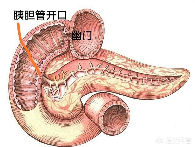 如果有十二指肠溃疡<strong>十二指肠</strong>，做了胆囊摘除术，不断流入的胆汁会不会加重病情？
