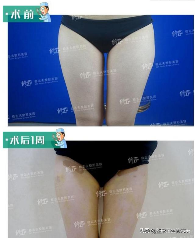快速减肥的方法有哪些<strong>减肥方法</strong>？