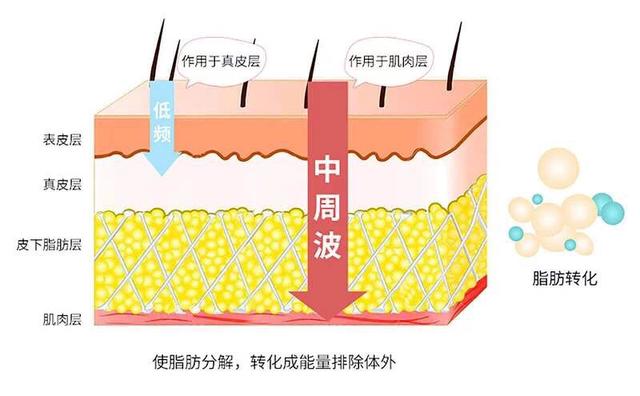 每天跳绳1000下<strong>跳绳减肥</strong>，坚持一个月，可以瘦下来吗？瘦多少斤呢？