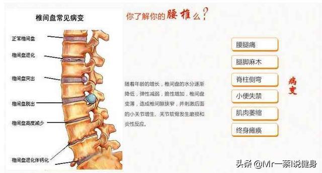 为什么跑步减肥不提倡<strong>跑步减肥</strong>？