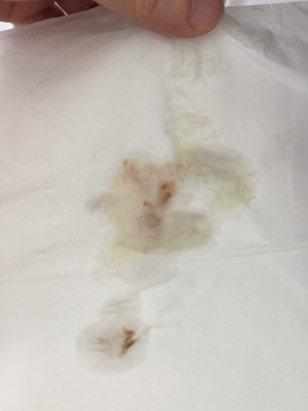 睡觉时射精是什么原因造成的,睡觉时射精是什么原因造成的女性
