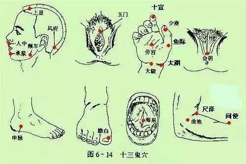 针灸鬼门十三针的定位鬼门十三针咒语