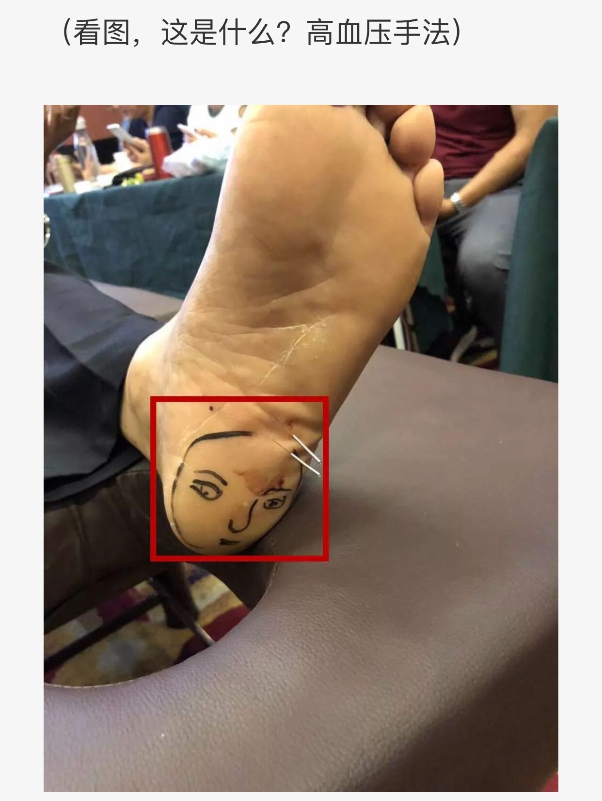 鬼门十三针真能治精神病吗,鬼门十三针的功效与作用