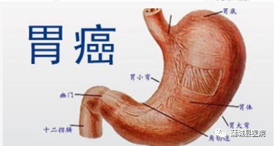 胃溃疡症状表现有哪些胃溃疡症状表现有哪些用什么药