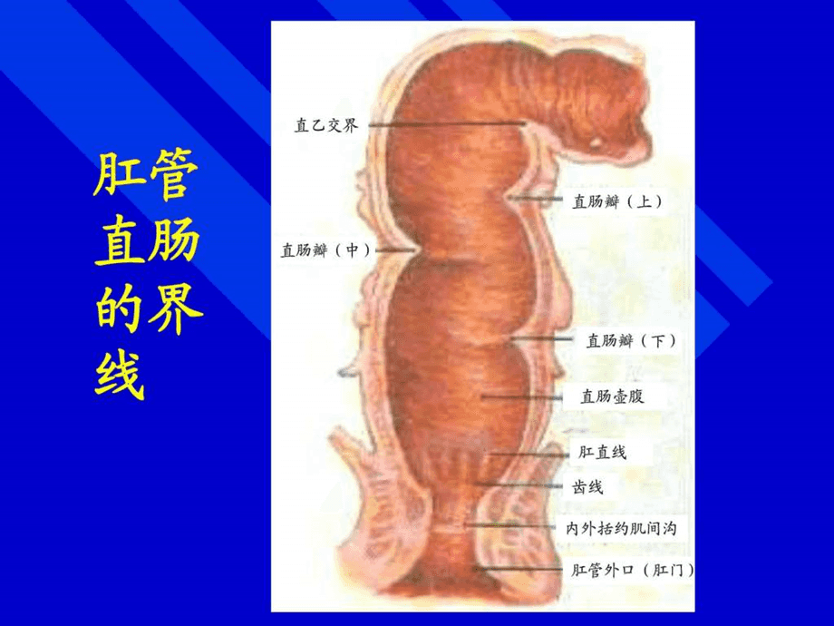 直肠癌能治好吗,直肠