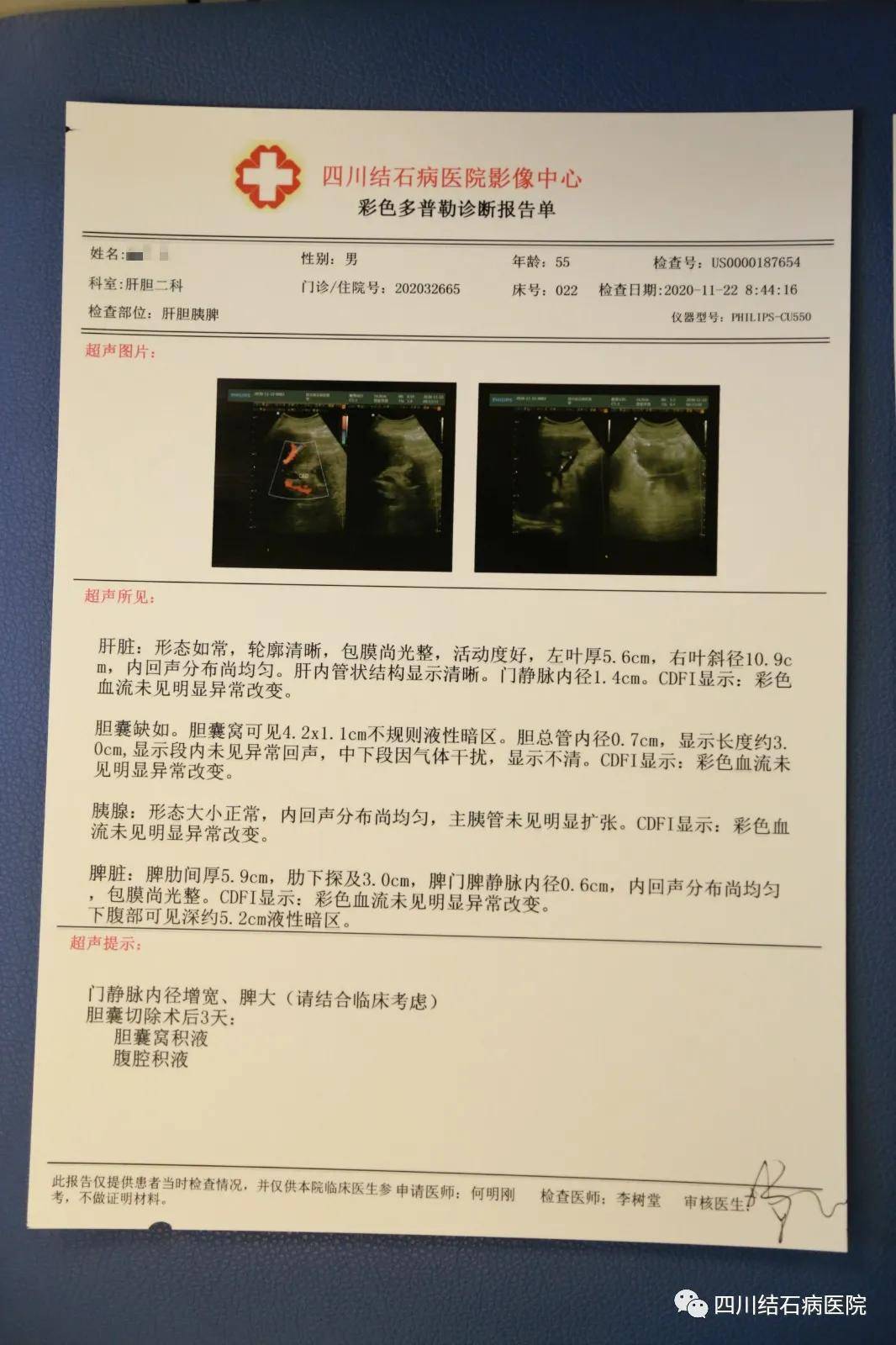 汉唐14号胆石症药方的简单介绍