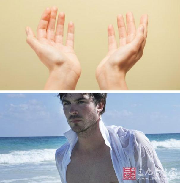 女性稍微一热就满头大汗老是出汗是什么原因男