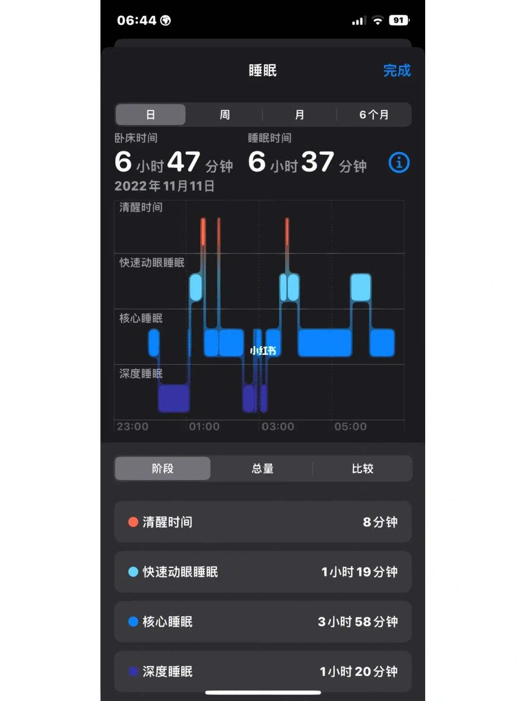 睡眠监测能查到什么病睡眠监测有什么用