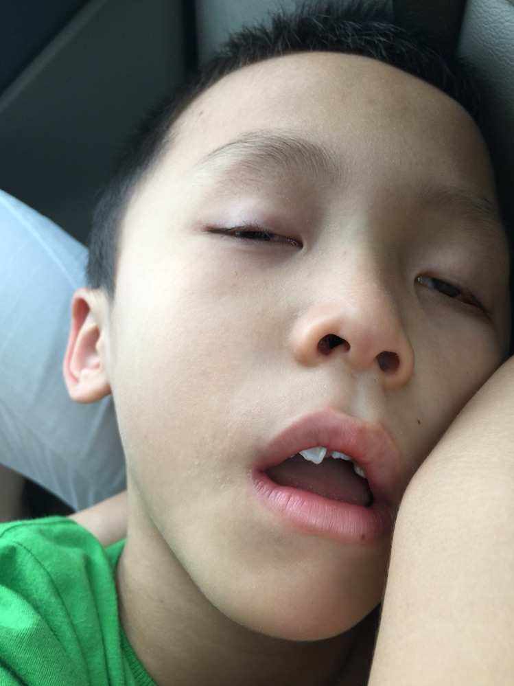睡着了会流口水是什么原因,睡着了会流口水是什么原因引起的