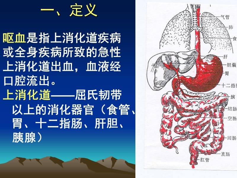 消化道出血消化道出血ppt课件