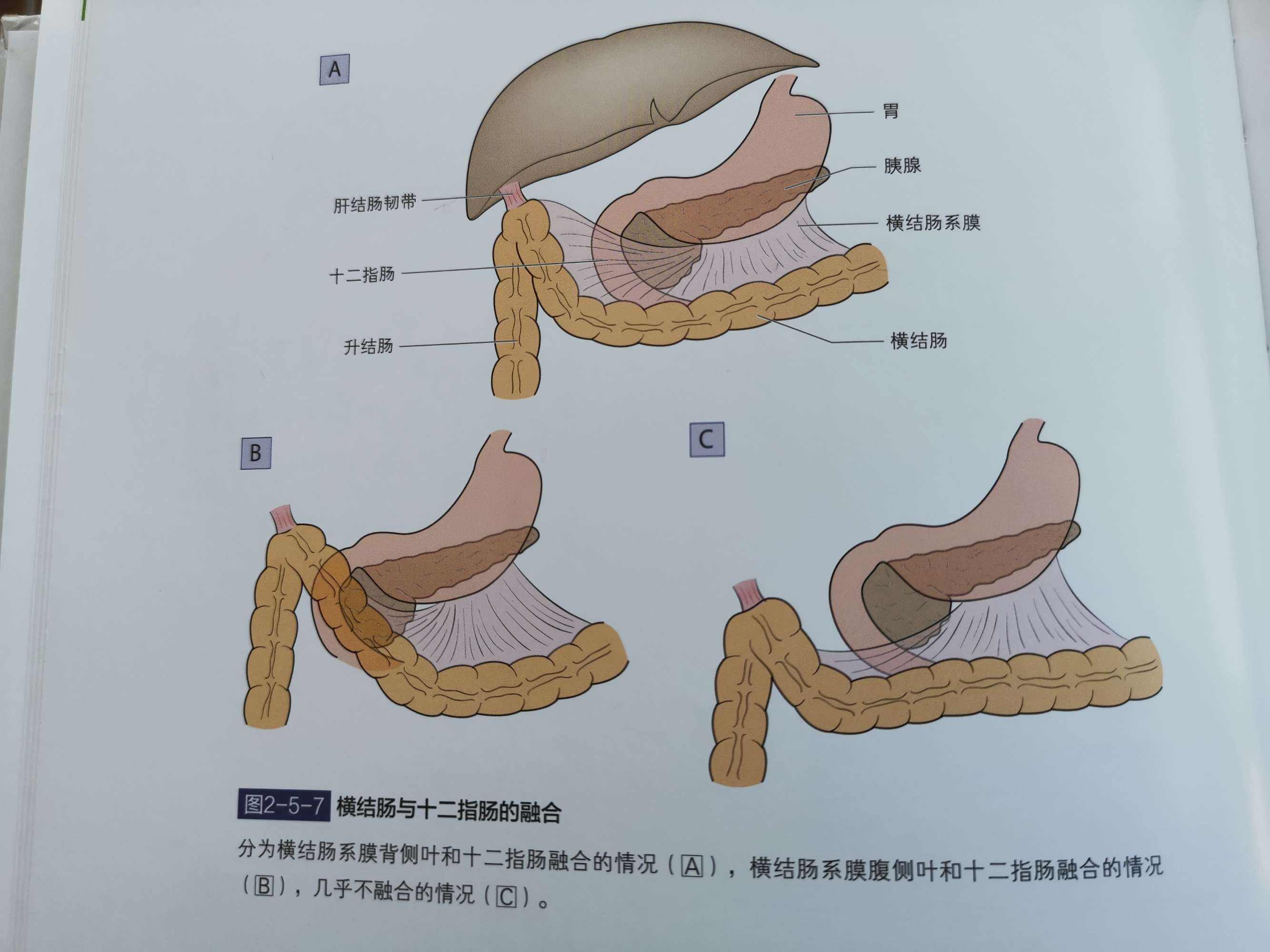 横结肠,横结肠肿瘤切除后可以活多久