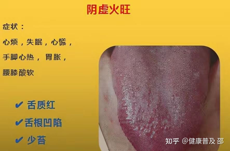入睡困难是心火还是肝火,阴虚火旺型失眠的症状