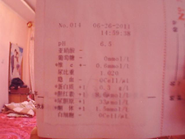 尿胆原偏高,尿常规尿胆原偏高