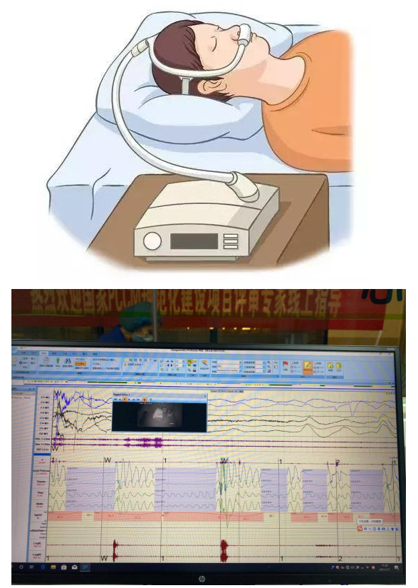 睡眠障碍看什么科室的医生,睡眠障碍看什么科室