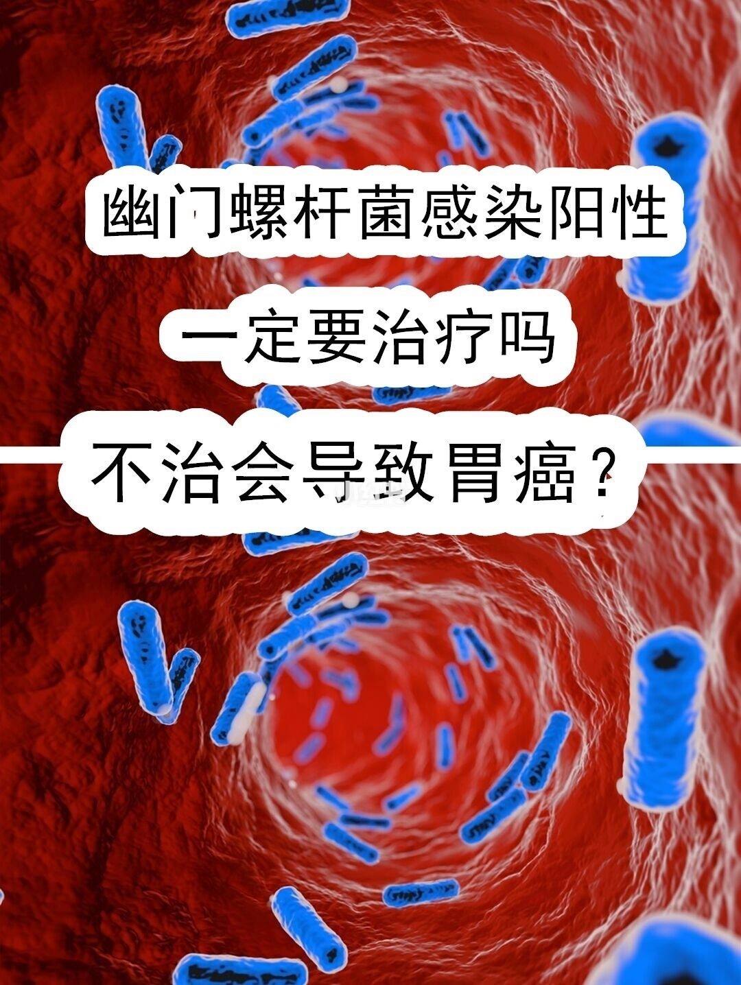幽门螺杆菌阳性口臭5米都能闻到正常吗幽门螺杆菌阳性口臭