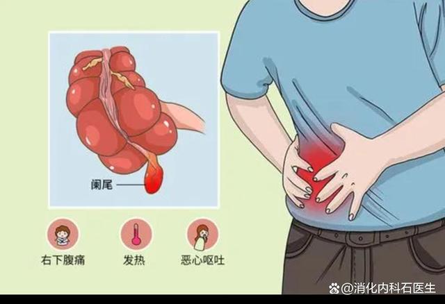 下腹痛鉴别诊断下腹痛