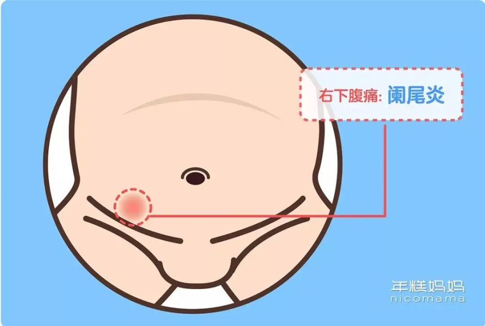 下腹痛鉴别诊断下腹痛