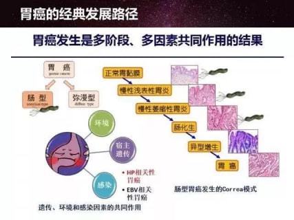 胃炎与胃癌自我辨别的方法,胃炎与胃癌自我辨别