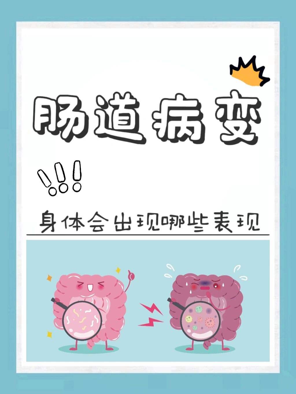 肠道疾病有哪些肠道疾病