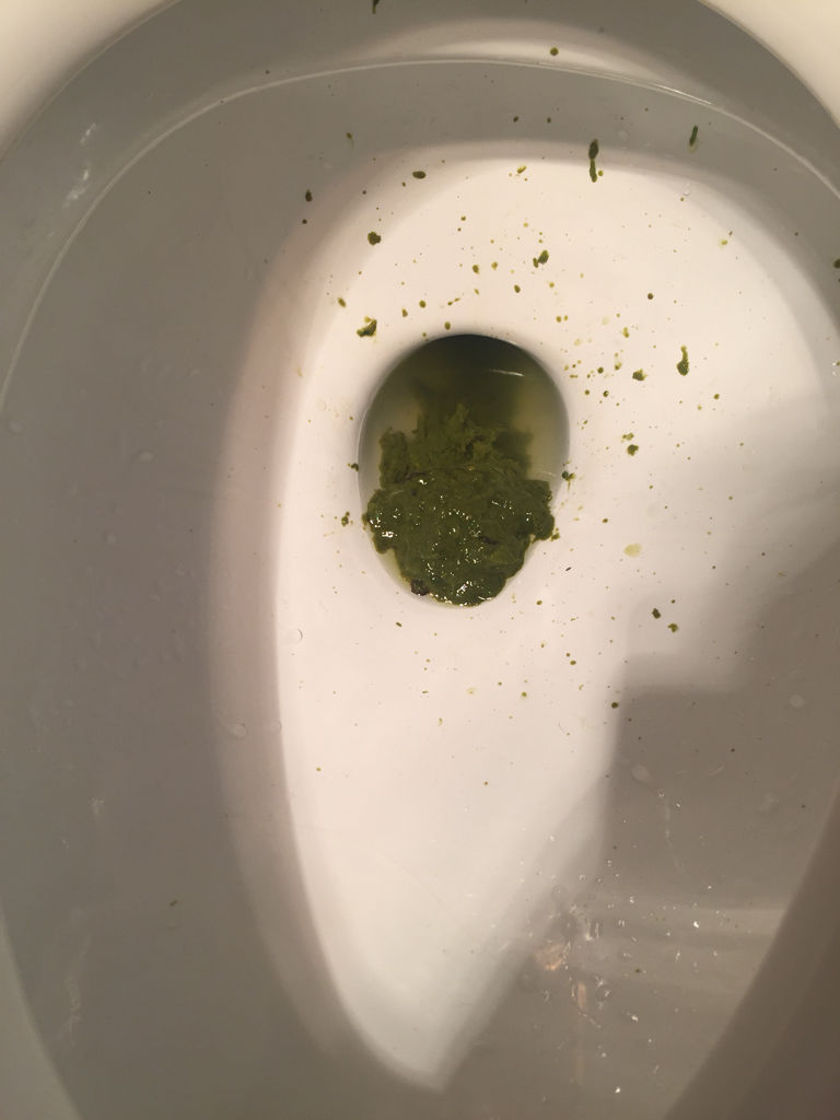 大便颜色9种图解,大便颜色