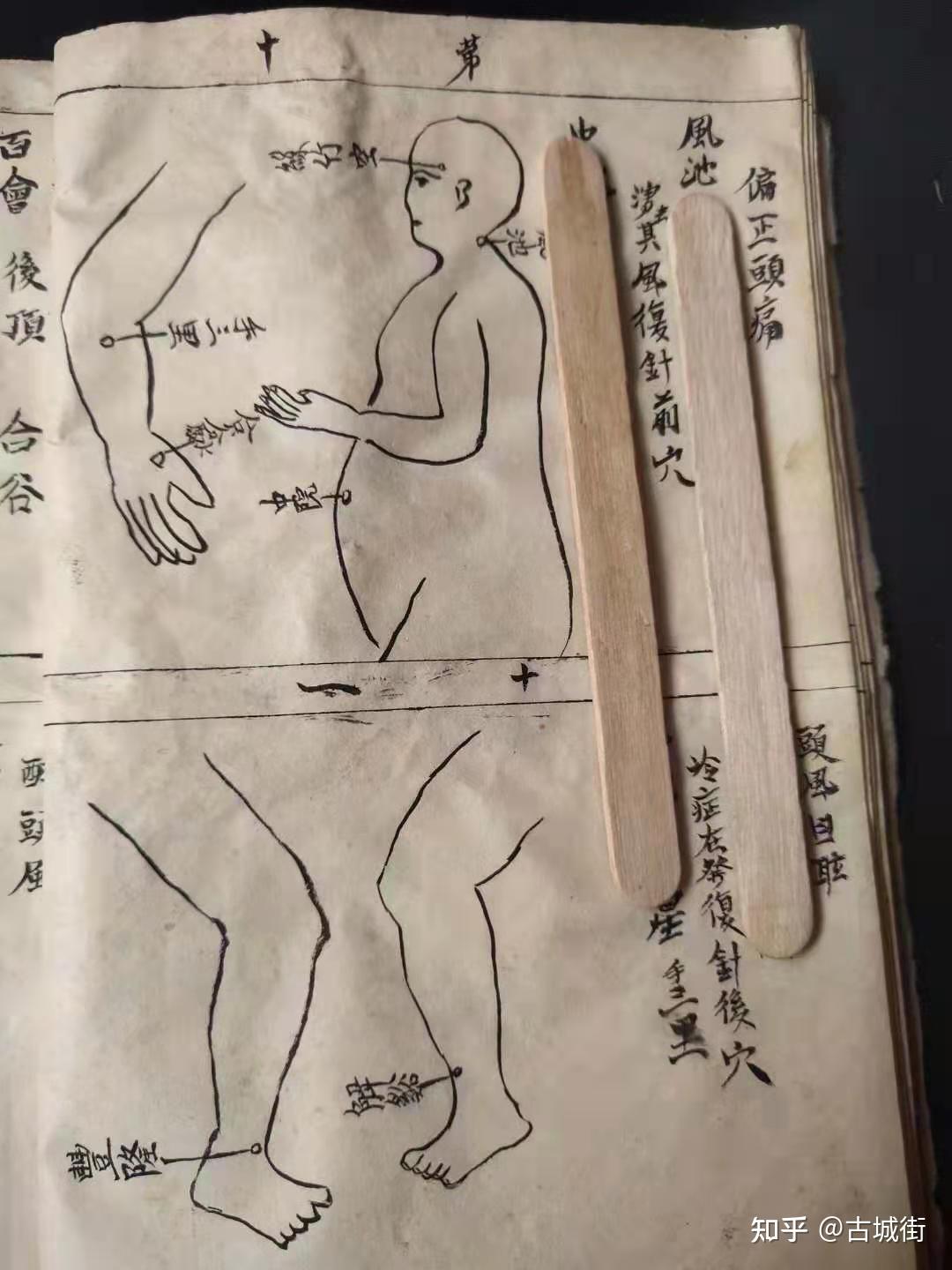 针灸咒语大全慎用,针灸咒语