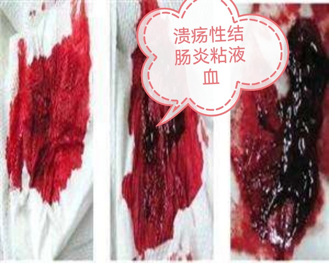 便血的原因,儿童便血的原因