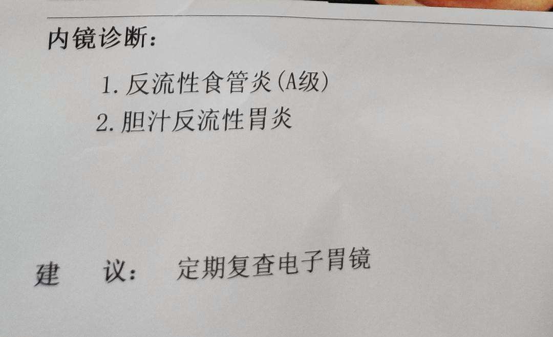 胆汁反流性胃炎,胆汁反流性胃炎症状表现有哪些