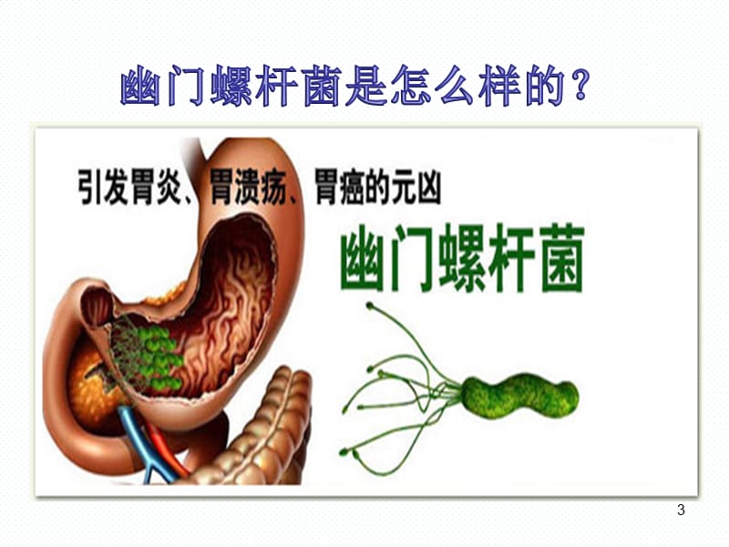 幽门螺杆菌,幽门螺杆菌阳性