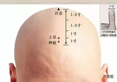 鬼门十三针为什么是禁针鬼门十三针为什么不能扎满