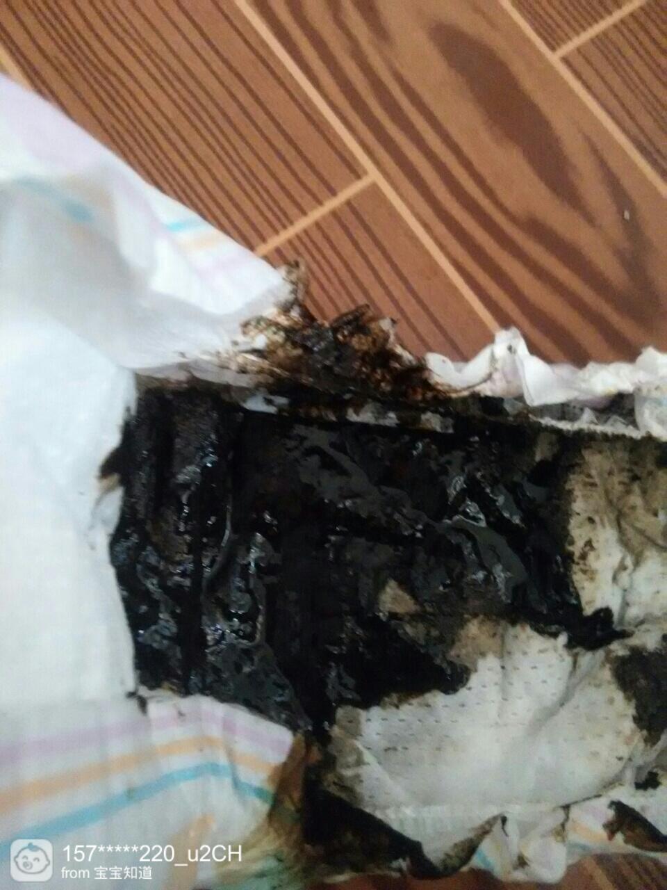 大便跟水一样喷射出来肚子咕噜咕噜,大便跟水一样喷射出来