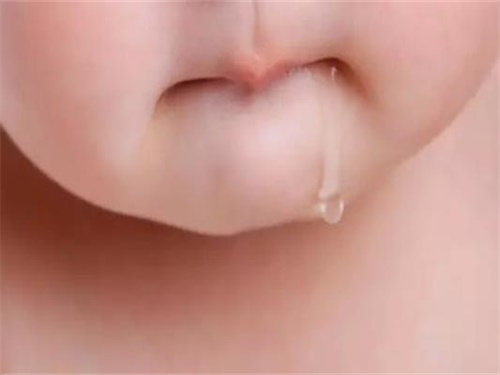 睡觉流口水是什么症状,血管堵塞是什么症状睡觉流口水是什么症状