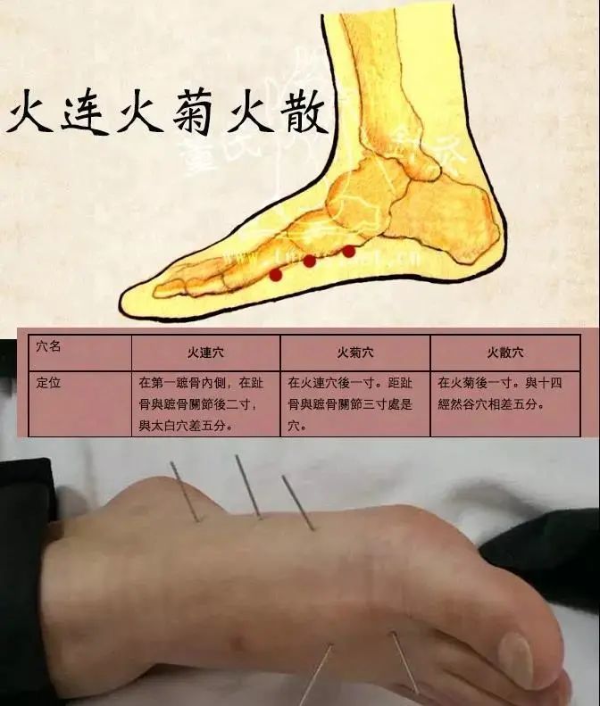 行针咒行针咒语
