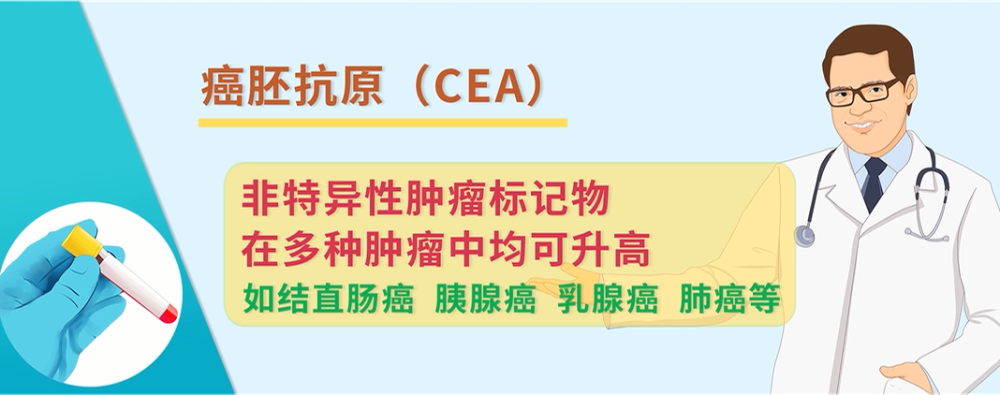 糖类抗原,糖类抗原242是什么肿瘤标志物