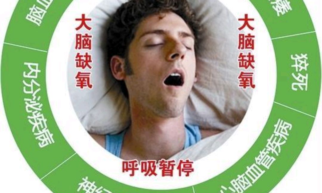 只要一睡着就打呼噜,不管什么睡姿,睡着就打鼾有什么方法可以解决