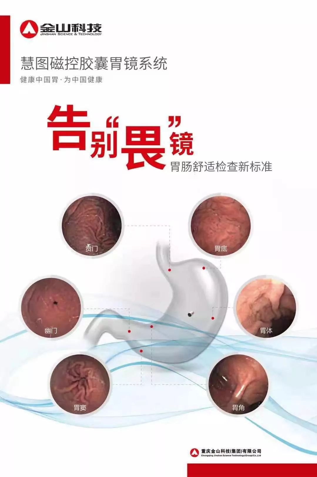 无痛胃镜检查,无痛胃镜检查后需要注意什么