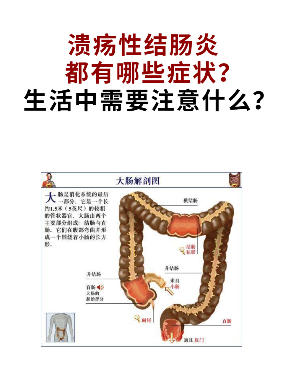结肠炎的症状及治疗青少年结肠炎的症状及治疗