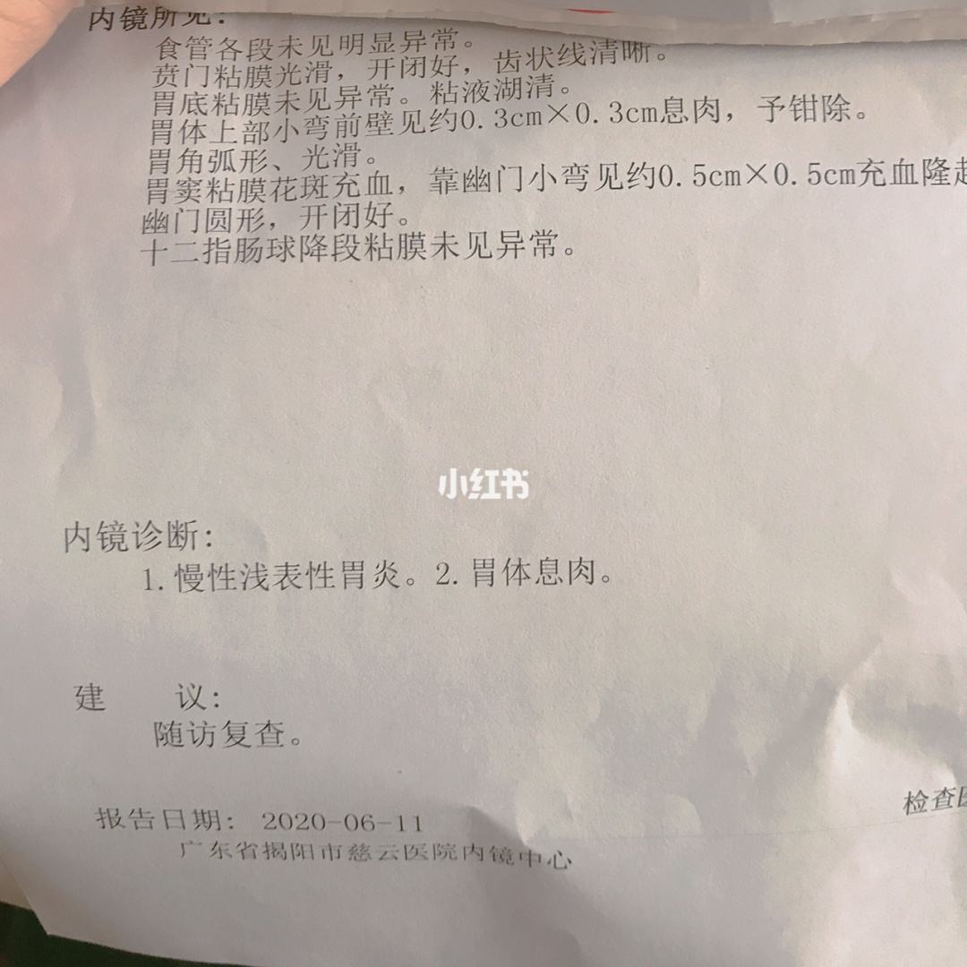胃窦炎的症状有哪些症状胃窦炎