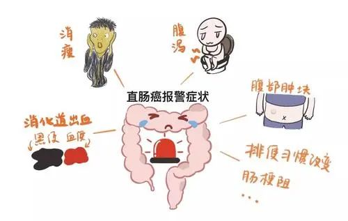 直肠癌早期的5大症状女性,直肠癌早期的5大症状