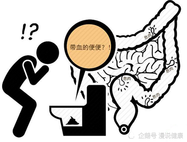 肠癌拉出来大便的图片肠癌拉出来大便的图片 颜色