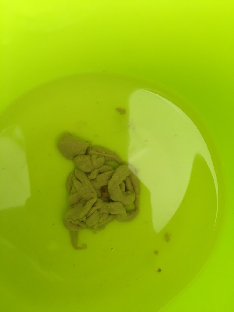 拉肚子拉水一样怎么办,宝宝拉肚子拉水一样怎么办