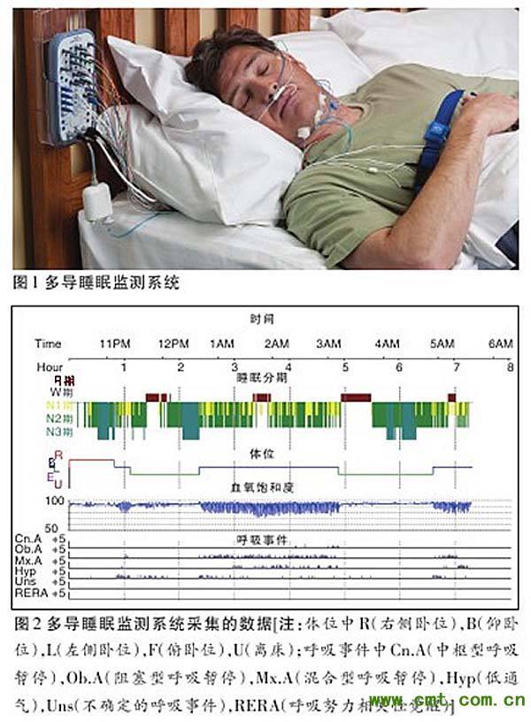 睡眠呼吸暂停综合症需要做什么检查,睡眠呼吸暂停综合症用什么仪器