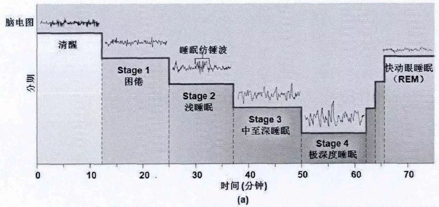 深度睡眠的表现猪进入深度睡眠的表现