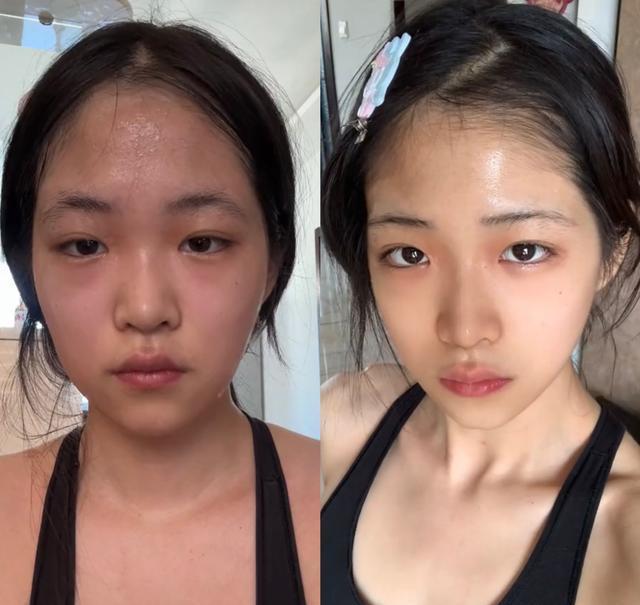 减肥后的皮肤松弛怎么办,减肥后的皮肤