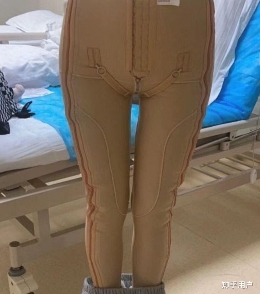 减肥吸脂减肥吸脂医院吸脂减肥收费