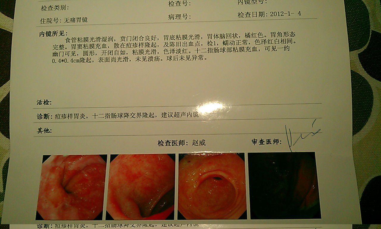 急性肠胃炎禁止喝水急性肠胃炎有些什么症状