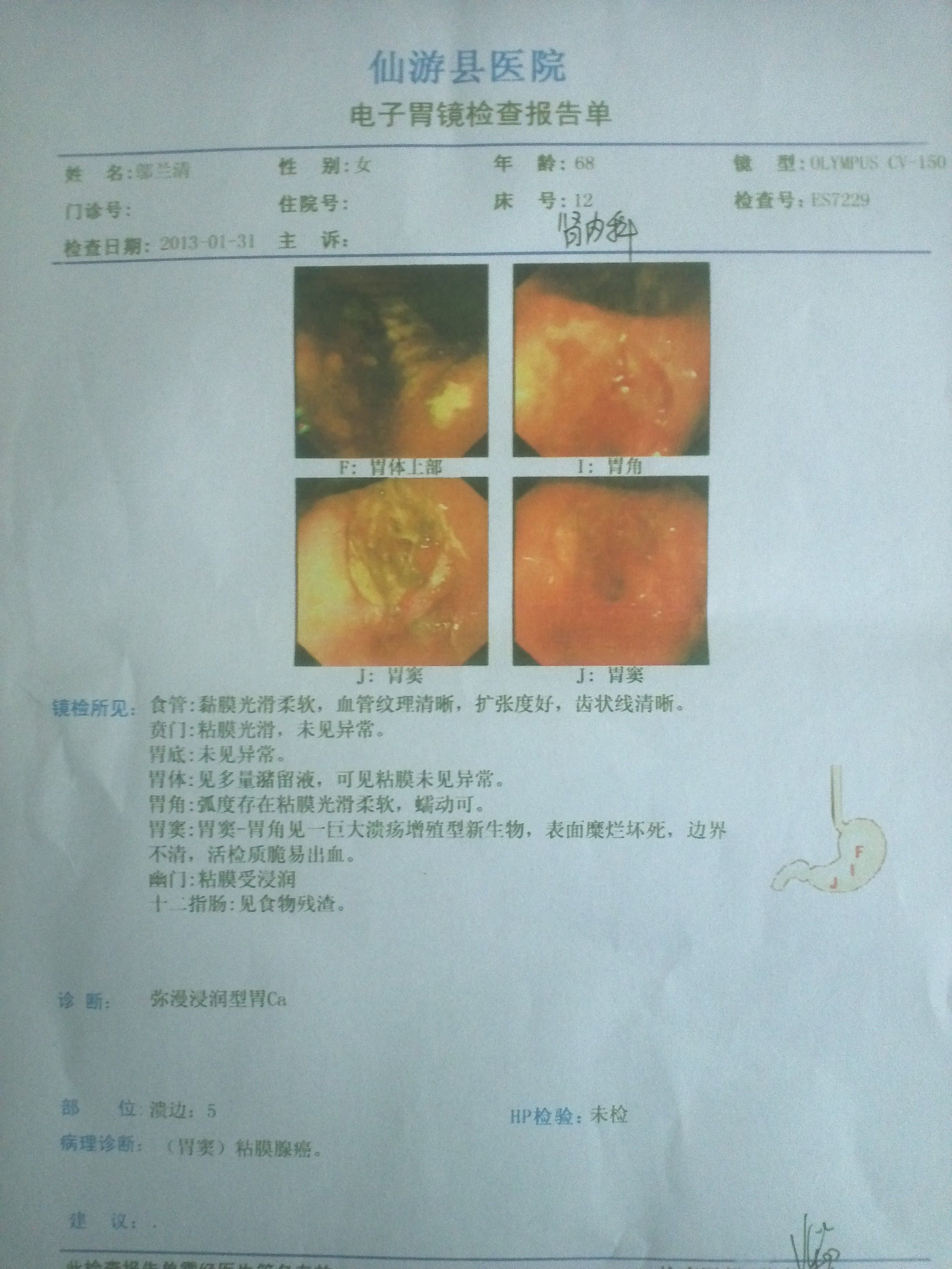 肠胃检查肠胃检查项目有哪些