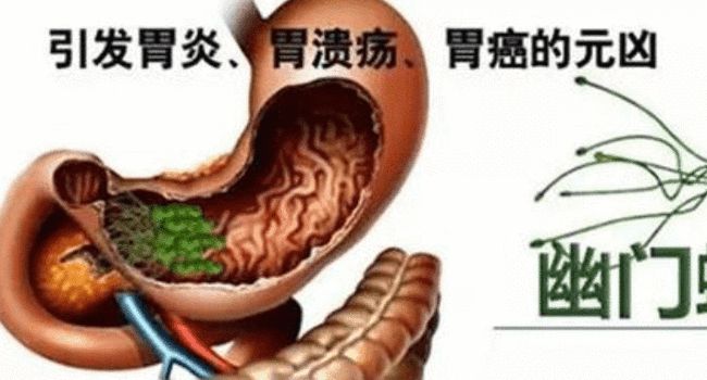 胃肠炎和肠胃炎区别肠胃炎的症状及治疗