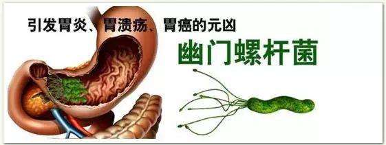 关于有螺旋杆菌会传染给家人吗的信息