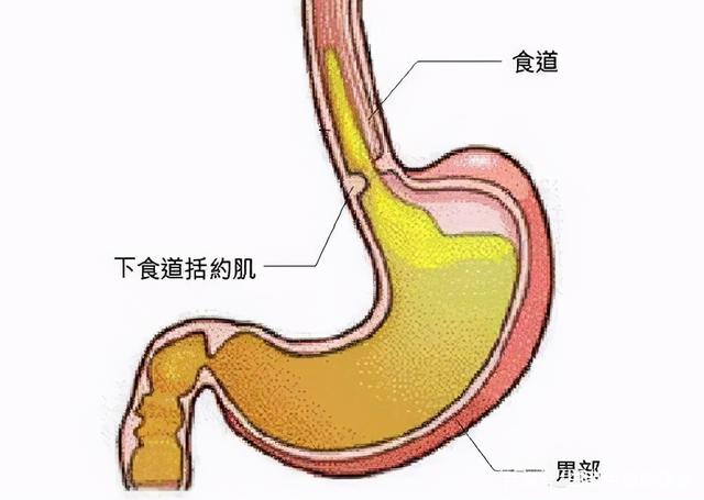反流性食管炎怎样才能治除根的简单介绍